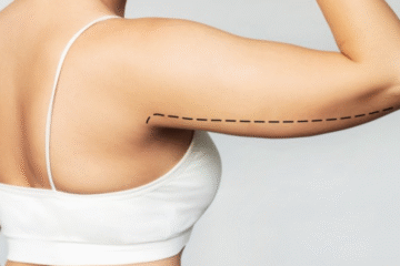Brachioplasty Consultation